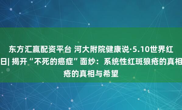 东方汇赢配资平台 河大附院健康说·5.10世界红斑狼疮日| 揭开“不死的癌症”面纱：系统性红斑狼疮的真相与希望